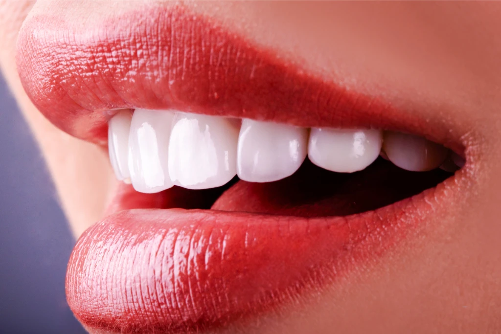 Full Mouth Dental Implants